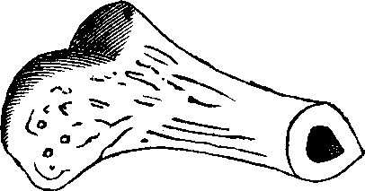 Illustration:
Fig. 9. Lower end of the thigh-bone sawn across, showing its central
cavity.