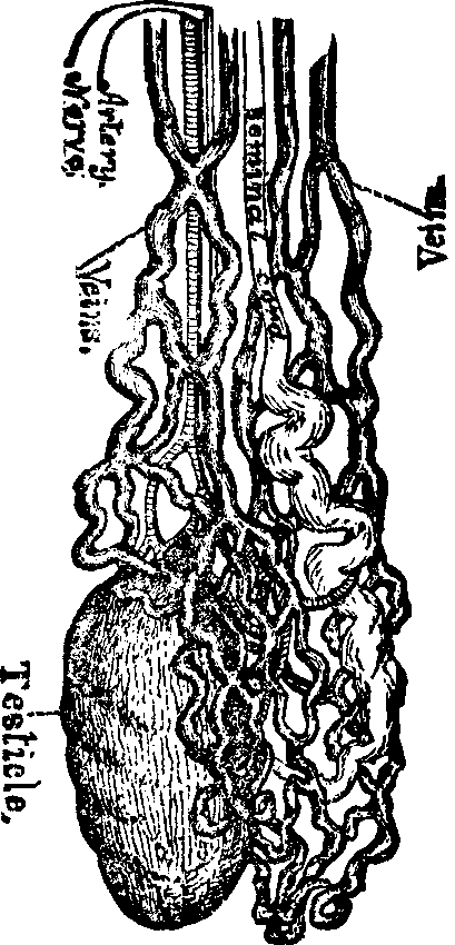Illustration:
Fig. 2. A Testicle wasted by Masturbation.