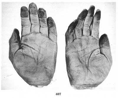 Fig. 407