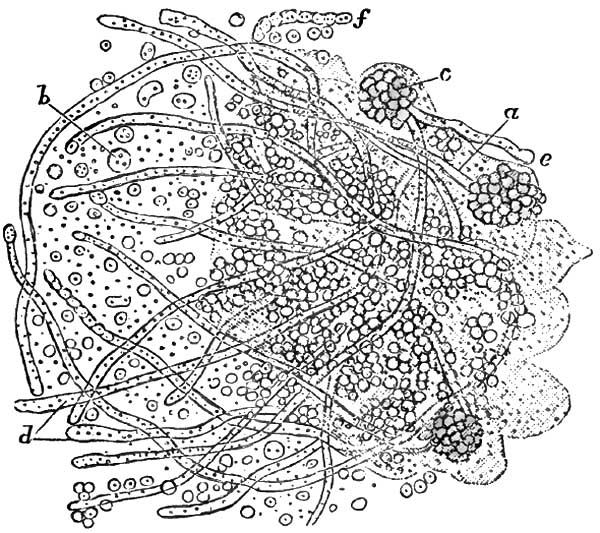 O�dium albicans