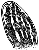 X-RAY OF FOOT

Properly housed in form fitting shoes