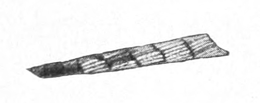 Spiral ribbon case