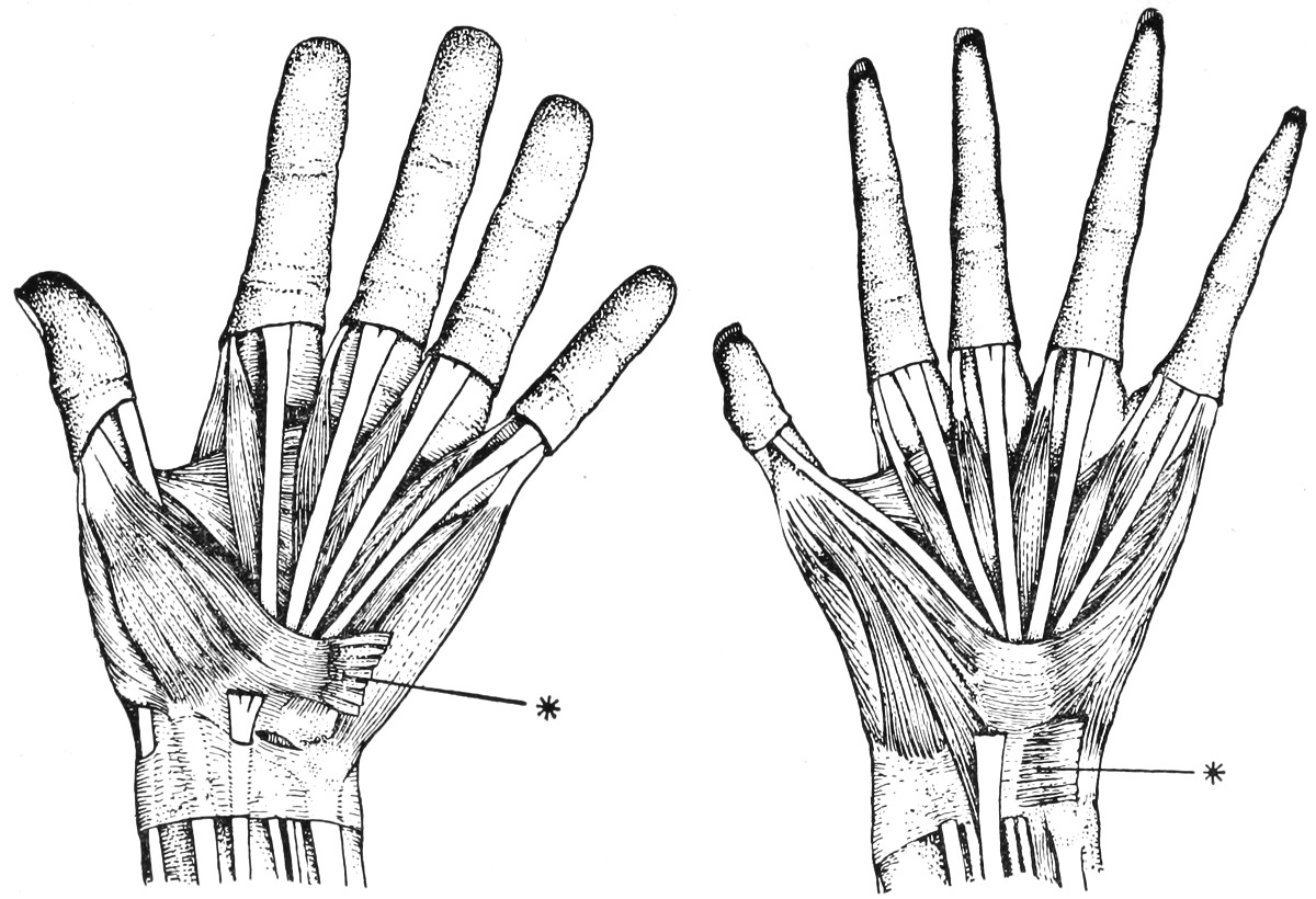 figures 19 and 20