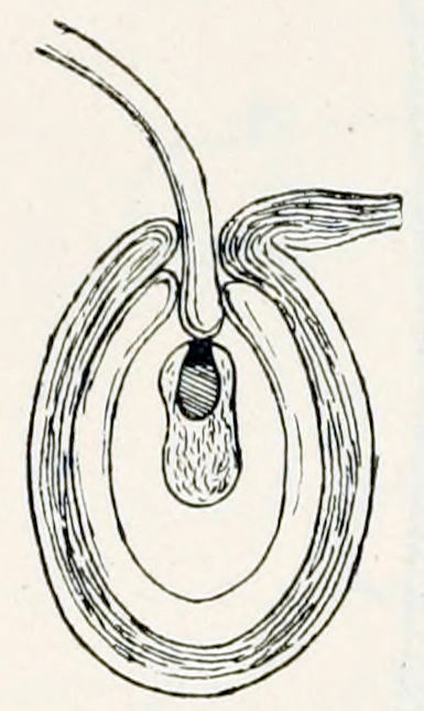 A microscopic image of a cross-
section. It shows a round, hollow shape with thick walls and an opening at the top.
In the centre is a peanut-shaped object, with a black spot at the side directed
to the opening. A tube enters through the opening and contacts the peanut-shape
at the black spot.